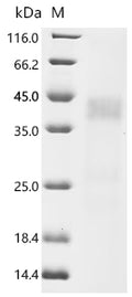 (Tris-Glycine gel) Discontinuous SDS-PAGE (reduced) with 5% enrichment gel and 15% separation gel.