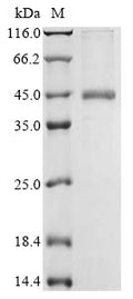 (Tris-Glycine gel) Discontinuous SDS-PAGE (reduced) with 5% enrichment gel and 15% separation gel.