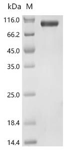 (Tris-Glycine gel) Discontinuous SDS-PAGE (reduced) with 5% enrichment gel and 15% separation gel.