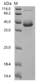 (Tris-Glycine gel) Discontinuous SDS-PAGE (reduced) with 5% enrichment gel and 15% separation gel.