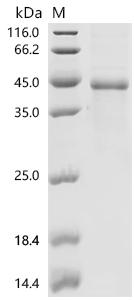 (Tris-Glycine gel) Discontinuous SDS-PAGE (reduced) with 5% enrichment gel and 15% separation gel.