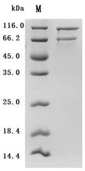 (Tris-Glycine gel) Discontinuous SDS-PAGE (reduced) with 5% enrichment gel and 15% separation gel.