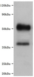 CSB-MP003996HU is detected by Mouse anti-6*His monoclonal antibody.