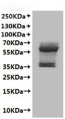 CSB-MP004839HU is detected by Mouse anti-6*His monoclonal antibody.