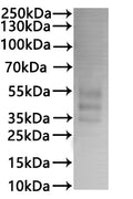 CSB-MP004842HU is detected by Mouse anti-6*His monoclonal antibody.