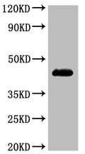 CSB-MP004843HU is detected by Mouse anti-6*His monoclonal antibody.