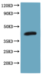 Recombinant Human C-C chemokine receptor type 8 (CCR8)-VLPs (Active) – Figure 1 of 6