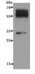 Recombinant Human C-C chemokine receptor type 9 (CCR9)-VLPs (Active) – Figure 1 of 3