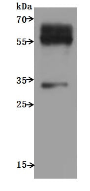 Recombinant Human C-C chemokine receptor type 9 (CCR9)-VLPs (Active) – Figure 1 of 3