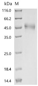 (Tris-Glycine gel) Discontinuous SDS-PAGE (reduced) with 5% enrichment gel and 15% separation gel.