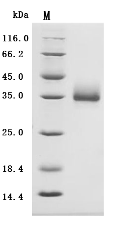 (Tris-Glycine gel) Discontinuous SDS-PAGE (reduced) with 5% enrichment gel and 15% separation gel.