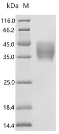 (Tris-Glycine gel) Discontinuous SDS-PAGE (reduced) with 5% enrichment gel and 15% separation gel.