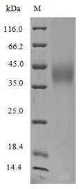 (Tris-Glycine gel) Discontinuous SDS-PAGE (reduced) with 5% enrichment gel and 15% separation gel.