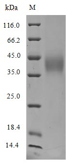 (Tris-Glycine gel) Discontinuous SDS-PAGE (reduced) with 5% enrichment gel and 15% separation gel.