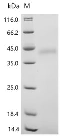 (Tris-Glycine gel) Discontinuous SDS-PAGE (reduced) with 5% enrichment gel and 15% separation gel.