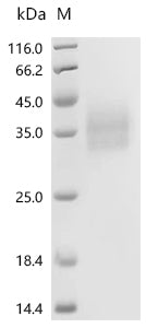 (Tris-Glycine gel) Discontinuous SDS-PAGE (reduced) with 5% enrichment gel and 15% separation gel.