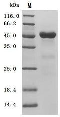 (Tris-Glycine gel) Discontinuous SDS-PAGE (reduced) with 5% enrichment gel and 15% separation gel.