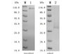 (Tris-Glycine gel) Discontinuous SDS-PAGE (reduced/non-reduced) with 5% enrichment gel and 15% separation gel.