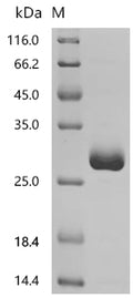 Recombinant Human Chromogranin-A (CHGA), partial – Figure 1 of 1