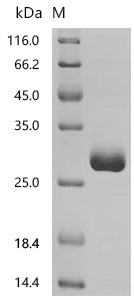 Recombinant Human Chromogranin-A (CHGA), partial – Figure 1 of 1