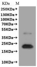 CSB-MP005490HU is detected by Mouse anti-6*His monoclonal antibody.