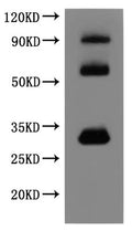 ①CSB-MP005498HU(A5) is detected by Mouse anti-6*His monoclonal antibody.The three bands respectively correspond to monomer, Homodimer, Homotrimer ②CSB-MP005498HU(A5) is detected by Anti-Claudin 18 Antibody.The two bands respectively correspond to monomer, Homodimer