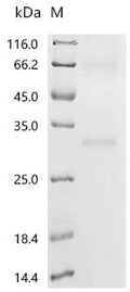 (Tris-Glycine gel) Discontinuous SDS-PAGE (reduced) with 5% enrichment gel and 15% separation gel.