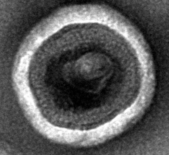 The presence of VLP-like structures was confirmed by TEM.