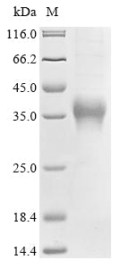 (Tris-Glycine gel) Discontinuous SDS-PAGE (reduced) with 5% enrichment gel and 15% separation gel.