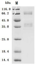 (Tris-Glycine gel) Discontinuous SDS-PAGE (reduced) with 5% enrichment gel and 15% separation gel.