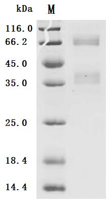 (Tris-Glycine gel) Discontinuous SDS-PAGE (reduced) with 5% enrichment gel and 15% separation gel.
