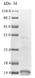 (Tris-Glycine gel) Discontinuous SDS-PAGE (reduced) with 5% enrichment gel and 15% separation gel.
