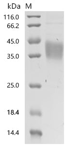 (Tris-Glycine gel) Discontinuous SDS-PAGE (reduced) with 5% enrichment gel and 15% separation gel.
