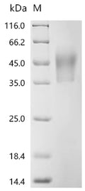 (Tris-Glycine gel) Discontinuous SDS-PAGE (reduced) with 5% enrichment gel and 15% separation gel.