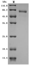(Tris-Glycine gel) Discontinuous SDS-PAGE (reduced) with 5% enrichment gel and 15% separation gel.
Predicted band size: 38.2 kDa
Observed band size:
(a) 68 kDa before EndoH Digestion
(b) 38 kDa after EndoH Digestion