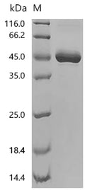 (Tris-Glycine gel) Discontinuous SDS-PAGE (reduced) with 5% enrichment gel and 15% separation gel.
