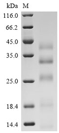 (Tris-Glycine gel) Discontinuous SDS-PAGE (reduced) with 5% enrichment gel and 15% separation gel.
