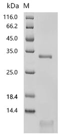 (Tris-Glycine gel) Discontinuous SDS-PAGE (reduced) with 5% enrichment gel and 15% separation gel.