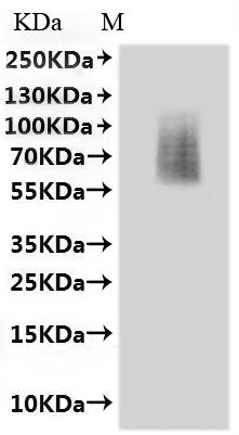 CSB-MP006253MO is detected by Mouse anti-6*His monoclonal antibody