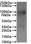 CSB-MP006255HUd7 is detected by Mouse anti-6*His monoclonal antibody