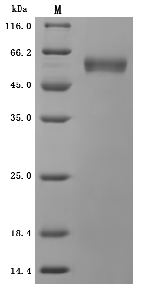 (Tris-Glycine gel) Discontinuous SDS-PAGE (reduced) with 5% enrichment gel and 15% separation gel.