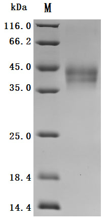 (Tris-Glycine gel) Discontinuous SDS-PAGE (reduced) with 5% enrichment gel and 15% separation gel.