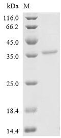 (Tris-Glycine gel) Discontinuous SDS-PAGE (reduced) with 5% enrichment gel and 15% separation gel.