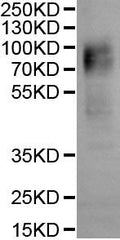 CSB-MP007403HU is detected by Mouse anti-6*His monoclonal antibody.