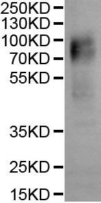 CSB-MP007403HU is detected by Mouse anti-6*His monoclonal antibody.