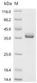 (Tris-Glycine gel) Discontinuous SDS-PAGE (reduced) with 5% enrichment gel and 15% separation gel.