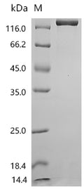 (Tris-Glycine gel) Discontinuous SDS-PAGE (reduced) with 5% enrichment gel and 15% separation gel.