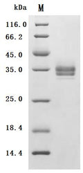 (Tris-Glycine gel) Discontinuous SDS-PAGE (reduced) with 5% enrichment gel and 15% separation gel.