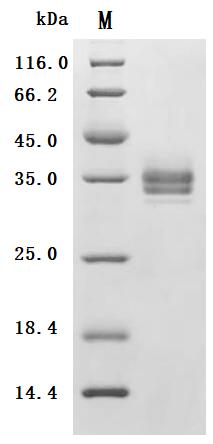 (Tris-Glycine gel) Discontinuous SDS-PAGE (reduced) with 5% enrichment gel and 15% separation gel.