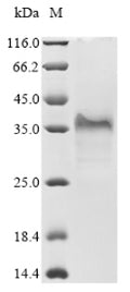 (Tris-Glycine gel) Discontinuous SDS-PAGE (reduced) with 5% enrichment gel and 15% separation gel.